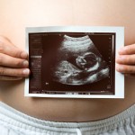 Pregnant woman w/ ultrasound